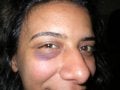Activist Manal Khaled was beaten severely
