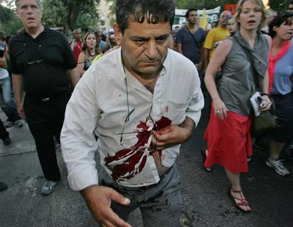 7.A participant in Jerusalem's Gay Pride continues to march after he was stabbed by a homophobic protester, July 1 © 2005 Reuters Limited.

