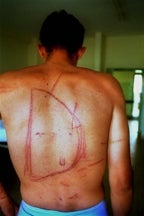 A Macedonian road worker shows wounds inflicted by Albanian rebels