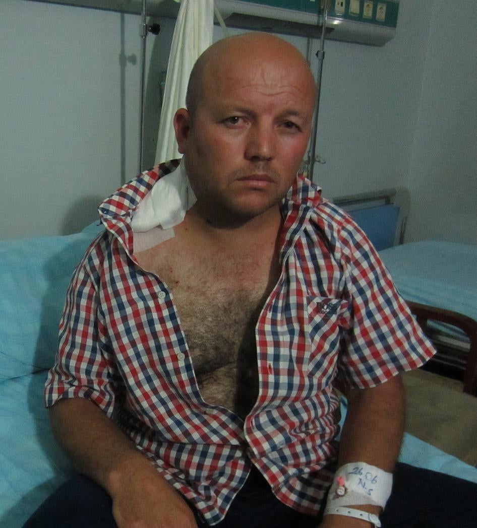 Khalil, 40, was shot in the neck by a sniper he believes was part of Islamic State during the June 15, 2015 attack on Kobani, while he was taking a wounded neighbor to the hospital. 
