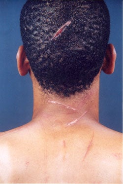 This man was beaten with sticks and cut with machetes by assailants who perceived that he was gay. Violent attacks against gay men are common in Jamaica. Photo: Jamaica Forum for Lesbians, All-Sexuals, and Gays