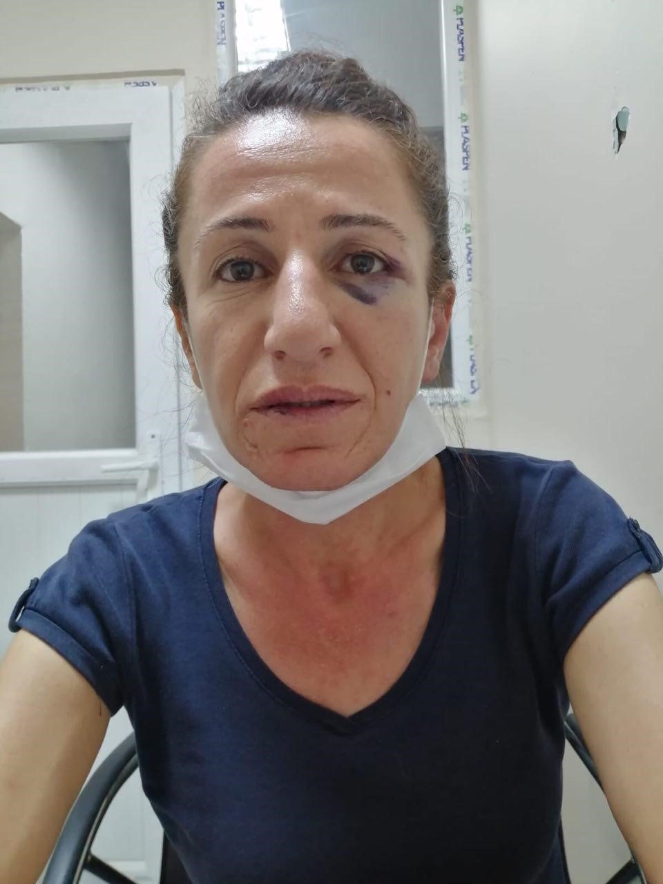 Sevil Cetin alleges she was attacked and bitten by police dogs and beaten by police officers in the apartment she was living in.