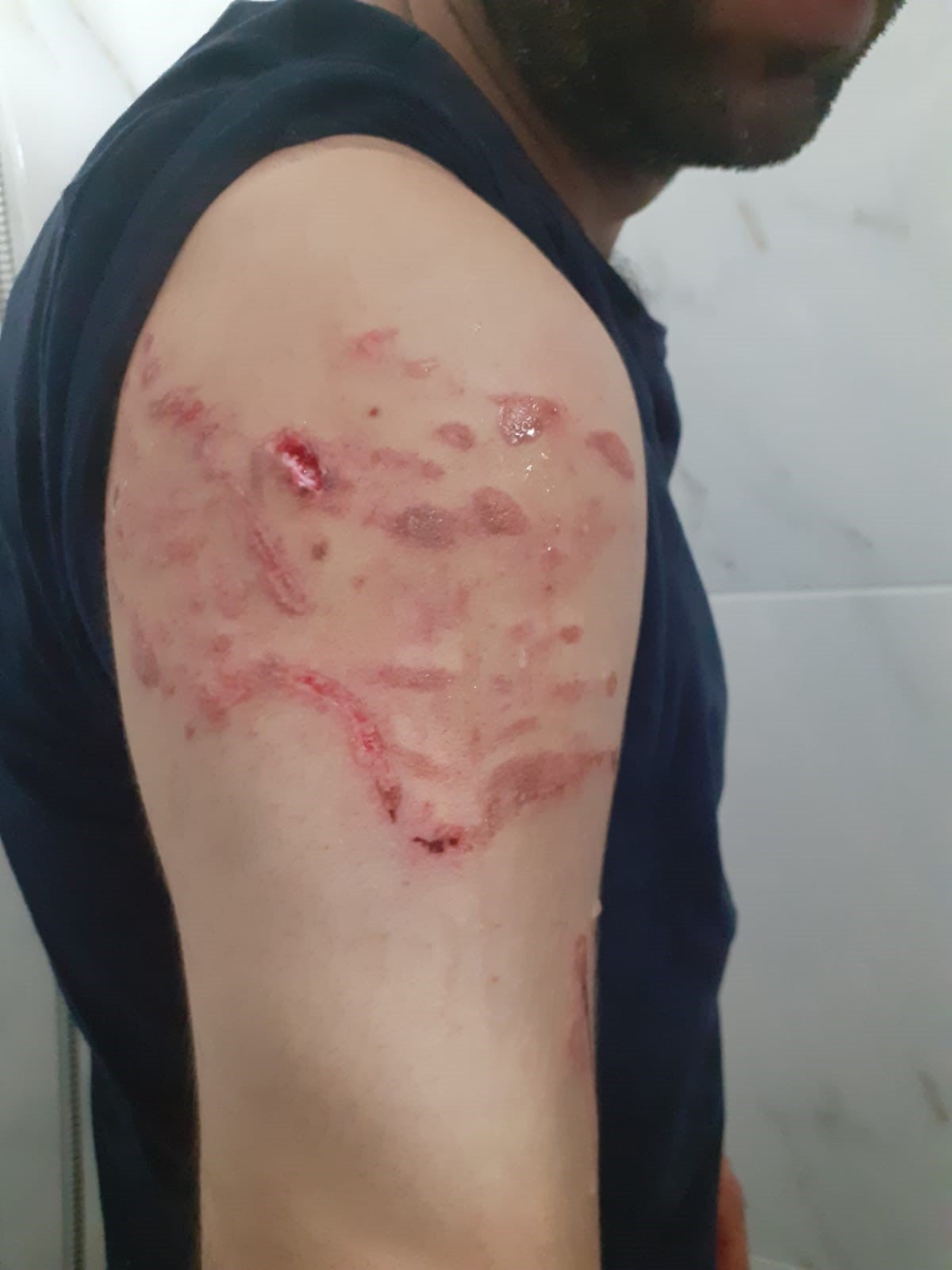 Seyhmus Yilmaz says he was bitten and scratched by police dogs and that police officers beat him.© 2020 Private