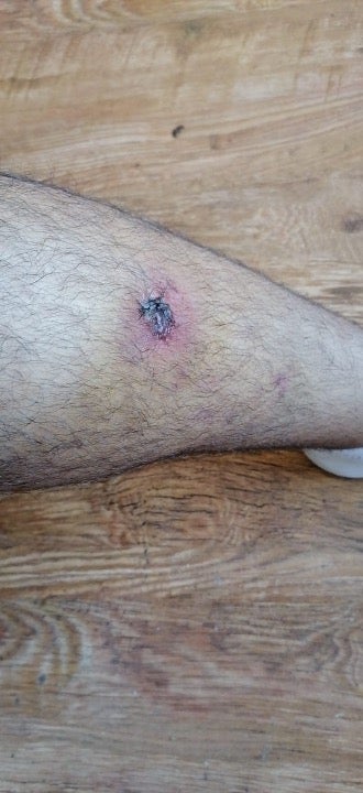 Videographer Makram Halabi was shot with a rubber ball in his leg while filming clashes between security forces and protesters.