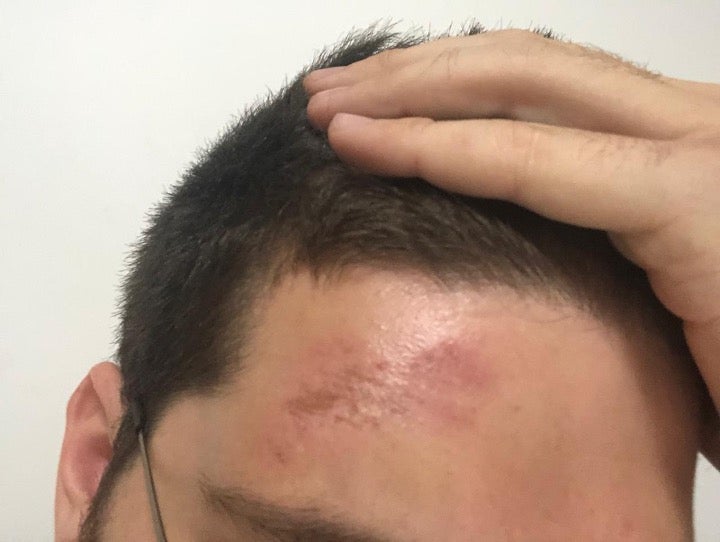 ضرب جندي الصحفي تيمور أزهري على رأسه بعصا.