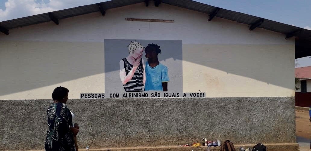 Flavia Pinto, head of Azemap, a volunteer-run organization that supports people with albinism, stands before a mural painted at a school in Tete province. The mural reads: "People with albinism are the same as you!"