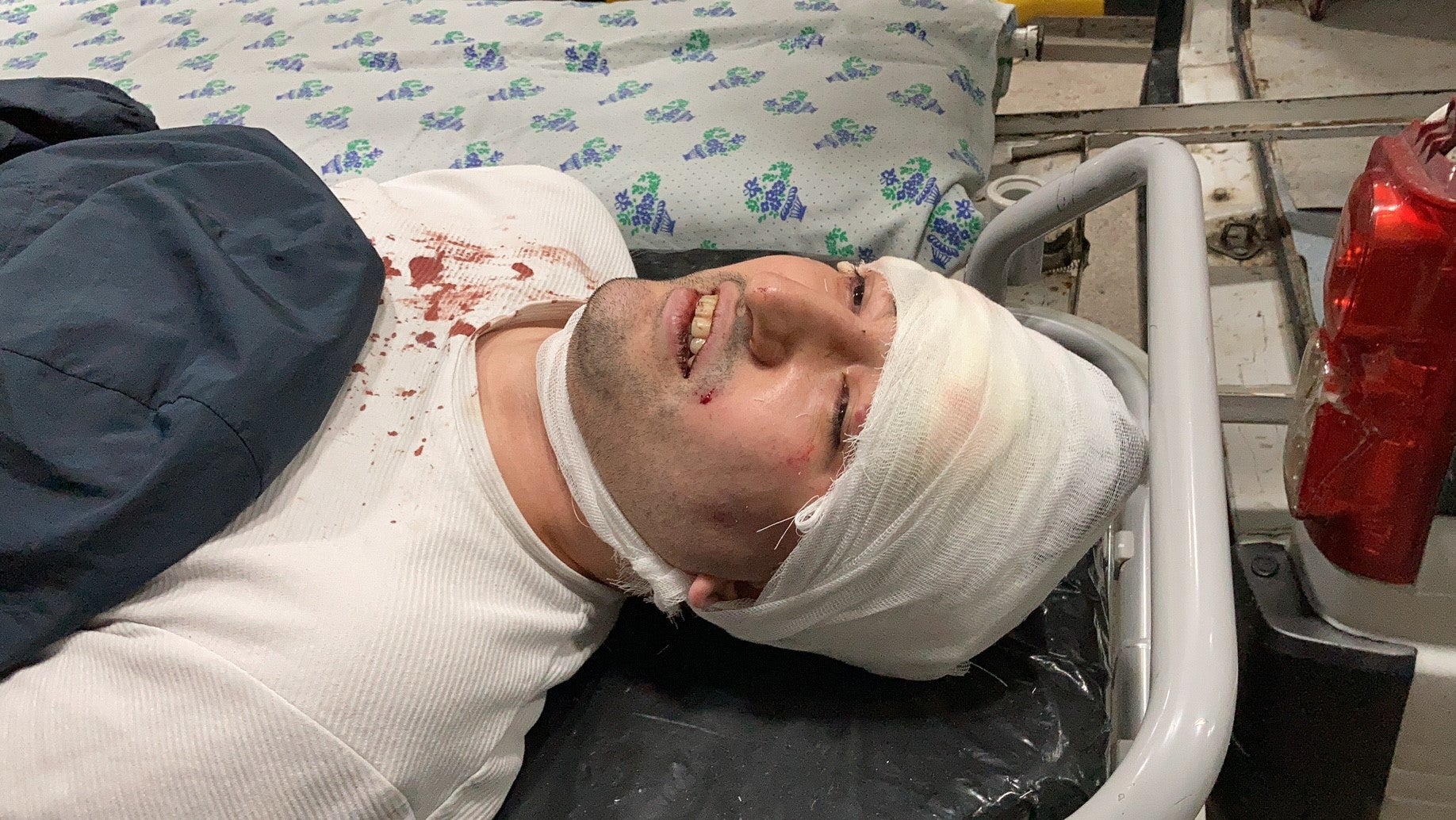 Миразиз Базаров в больнице Ташкента после нападения 28 марта.