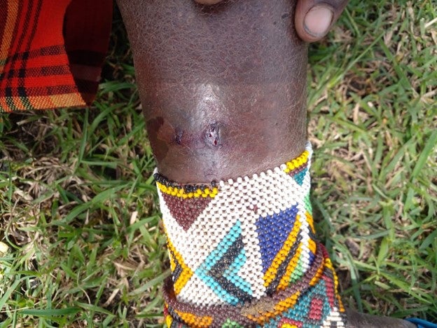 A Tanzanian Maasai woman shows her wounds after fleeing to Narok, Kenya for treatment. She said Tanzanian security forces shot and injured her leg with a rubber bullet in Loliondo, Arusha region, Tanzania, on June 10, 2022. 