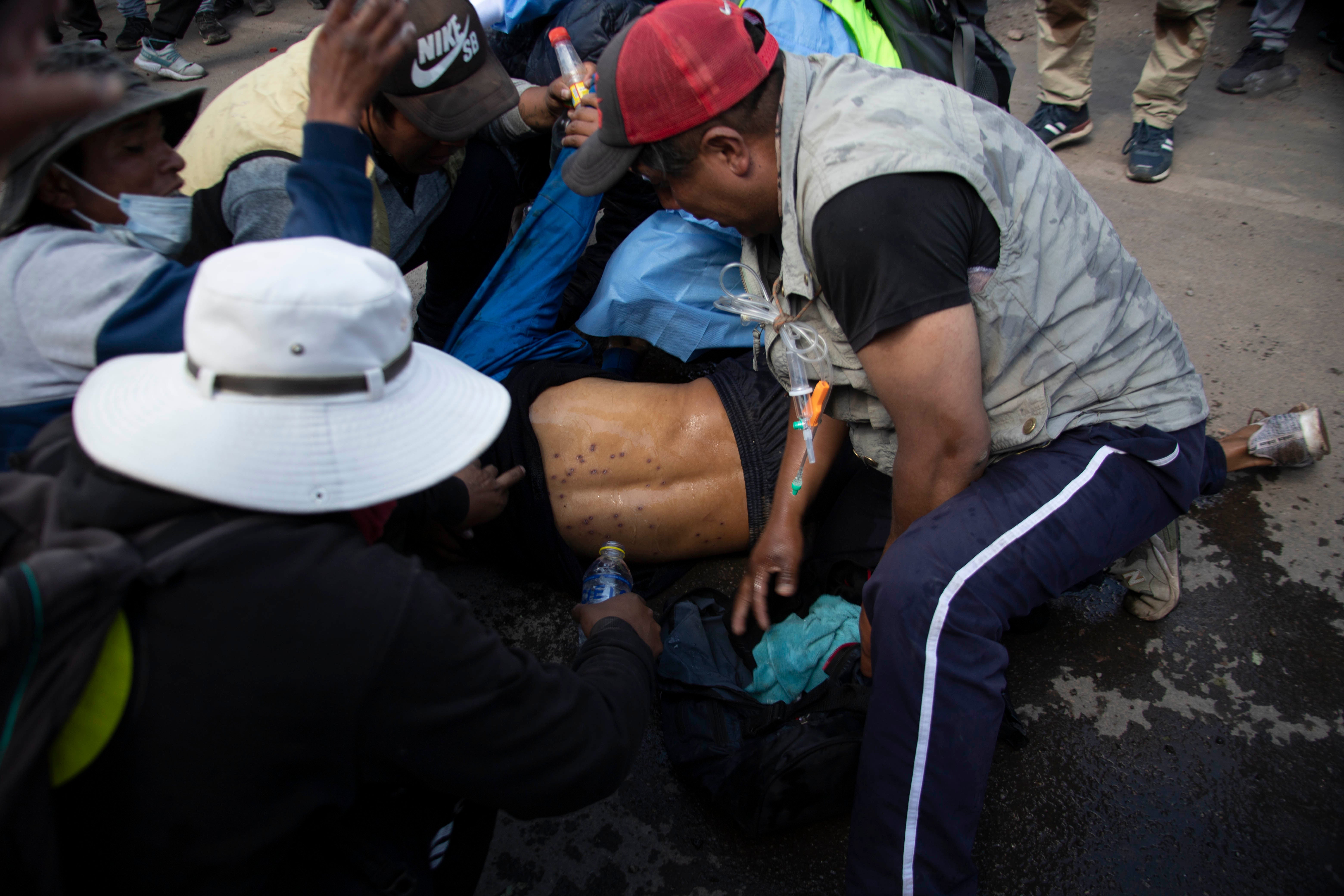 A man lying on the ground with pellet holes in his back