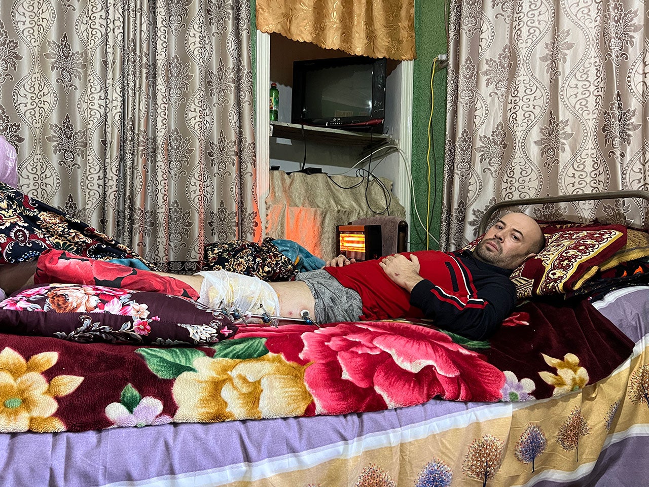 Shahriyor Khasanov, a 39-year-old shop owner who survived a Kyrgyz drone attack in Ovchi Kal’acha, said he was hit by metal fragments in the stomach and his leg was “almost separated” from his body.