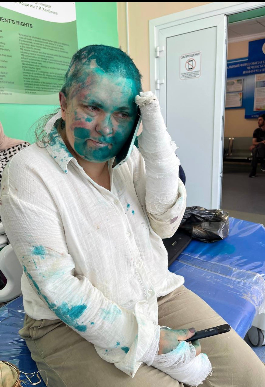 Elena Milashina in a hospital in Grozny, Chechnya after being violently attack on July 4, 2023