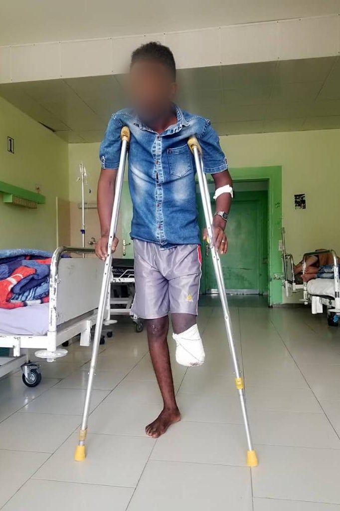 An amputee using crutches