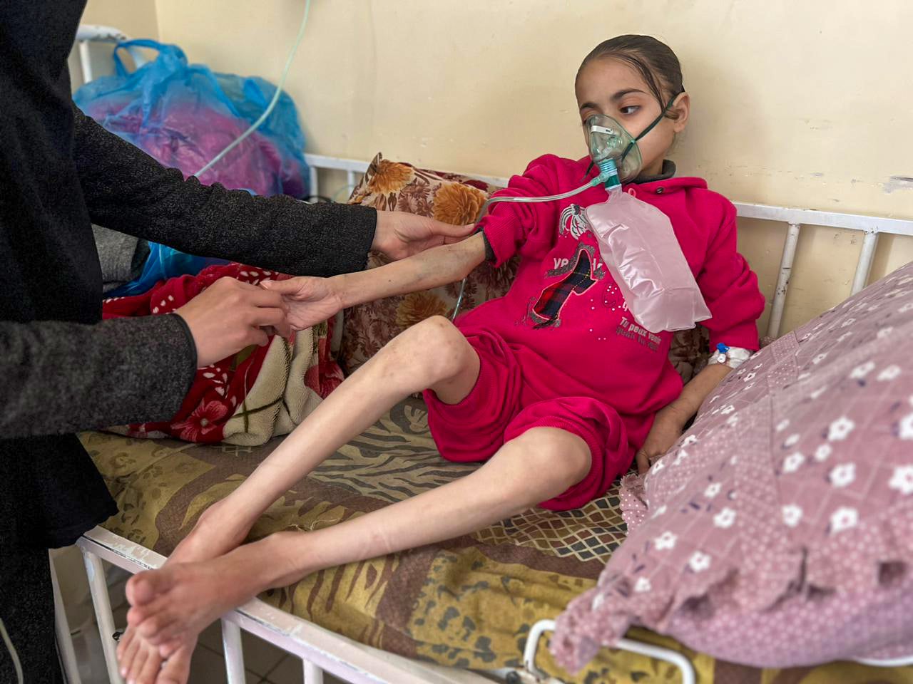 N. age 11, is being treated for malnutrition and severe dehydration at Kamal Adwan Hospital in Beit Lahia, Gaza, March 25, 2024.