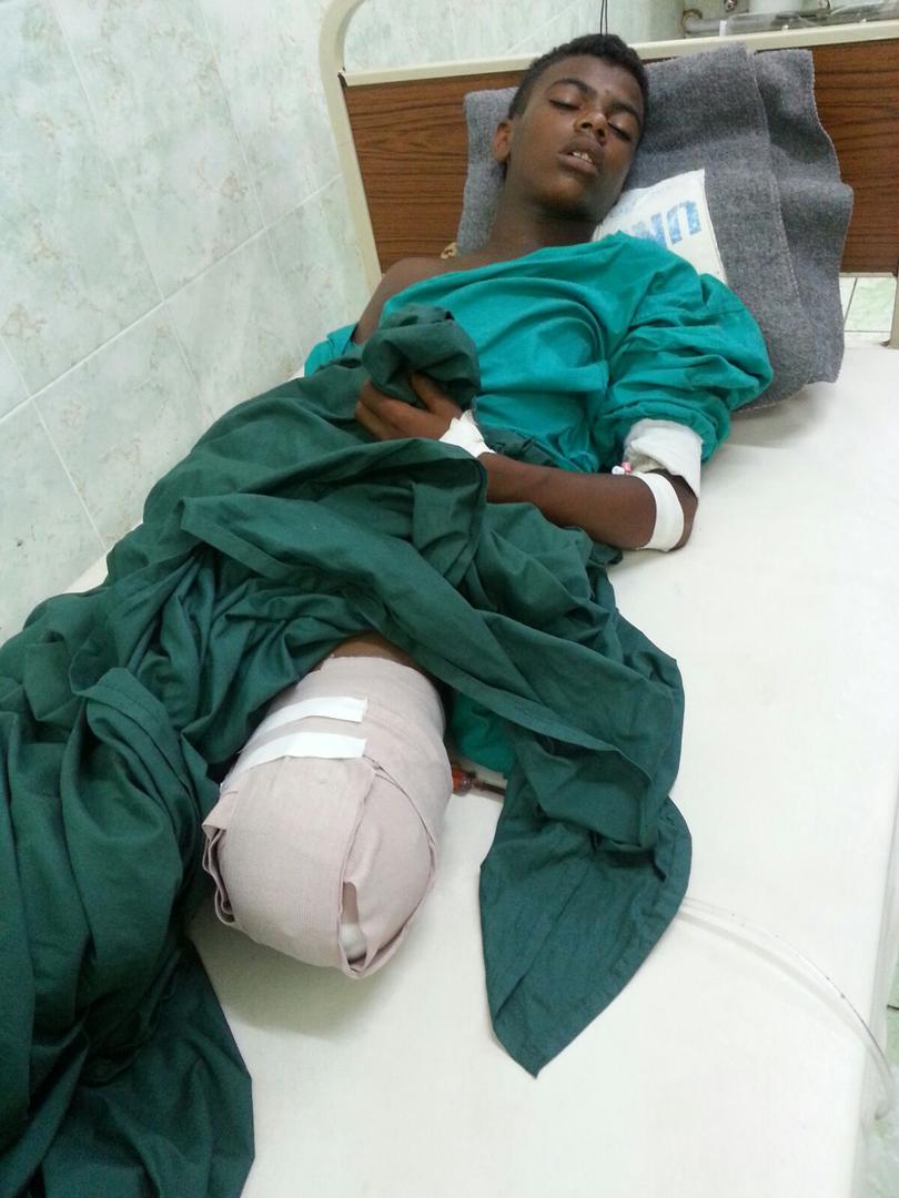Wa’el Khaled Muhammad al-Ruja`a, 15, lost his left leg in a landmine explosion near Aden International Airport on October 12, 2015.