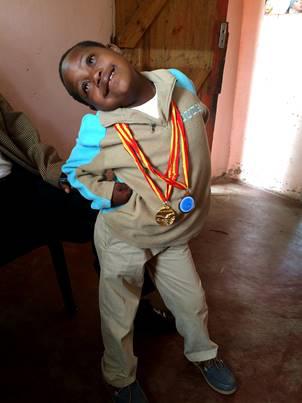 南非林波波省一名8岁大的唐氏症男童， 伊莱尼，展示他在运动项目中赢得的两面奖牌。
