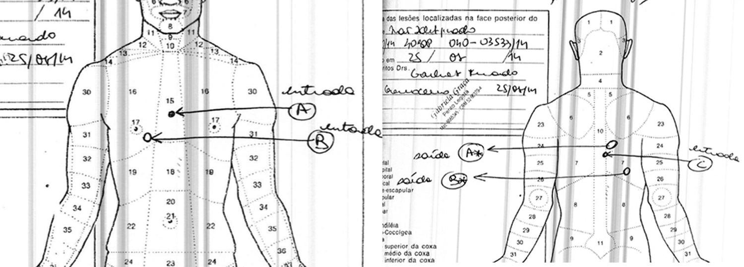 Os diagramas da autópsia do caso de Carlos Diego Santos da Silva mostram um ferimento (marcado como ‘C’) causado por uma bala que entrou pelas costas e permaneceu em seu corpo e dois orifícios de entrada próximos um do outro de tiros recebidos no peito (‘