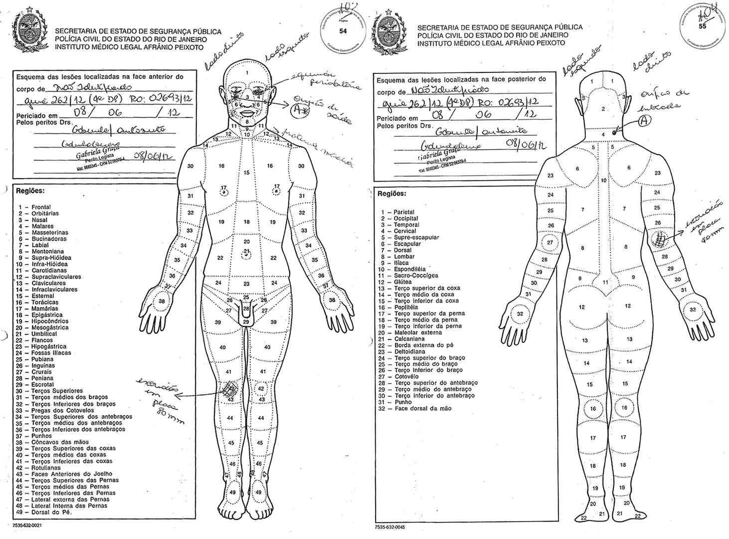  diagrama da autópsia do caso de Jackson Lessa dos Santos mostra um ferimento (marcado como “A”) causado por uma bala que entrou na nuca, e saiu pelo rosto, deixando um orifício de 2 centímetros. O orifício de entrada tinha a chamada “orla de tatuagem”, i