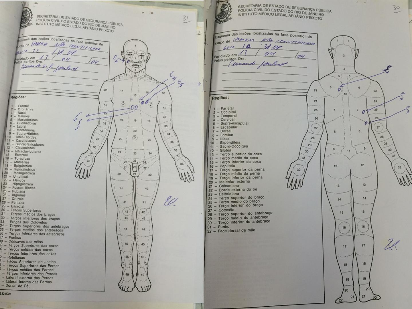 The autopsy diagram on the left shows one entry wound in the face (marked “E1”) of the victim, Leandro Ferraz Freitas, two entry wounds in the chest, very close to each other (marked “E4,” and “E5,”), and two exit wounds (marked “S2” and “S3”). 