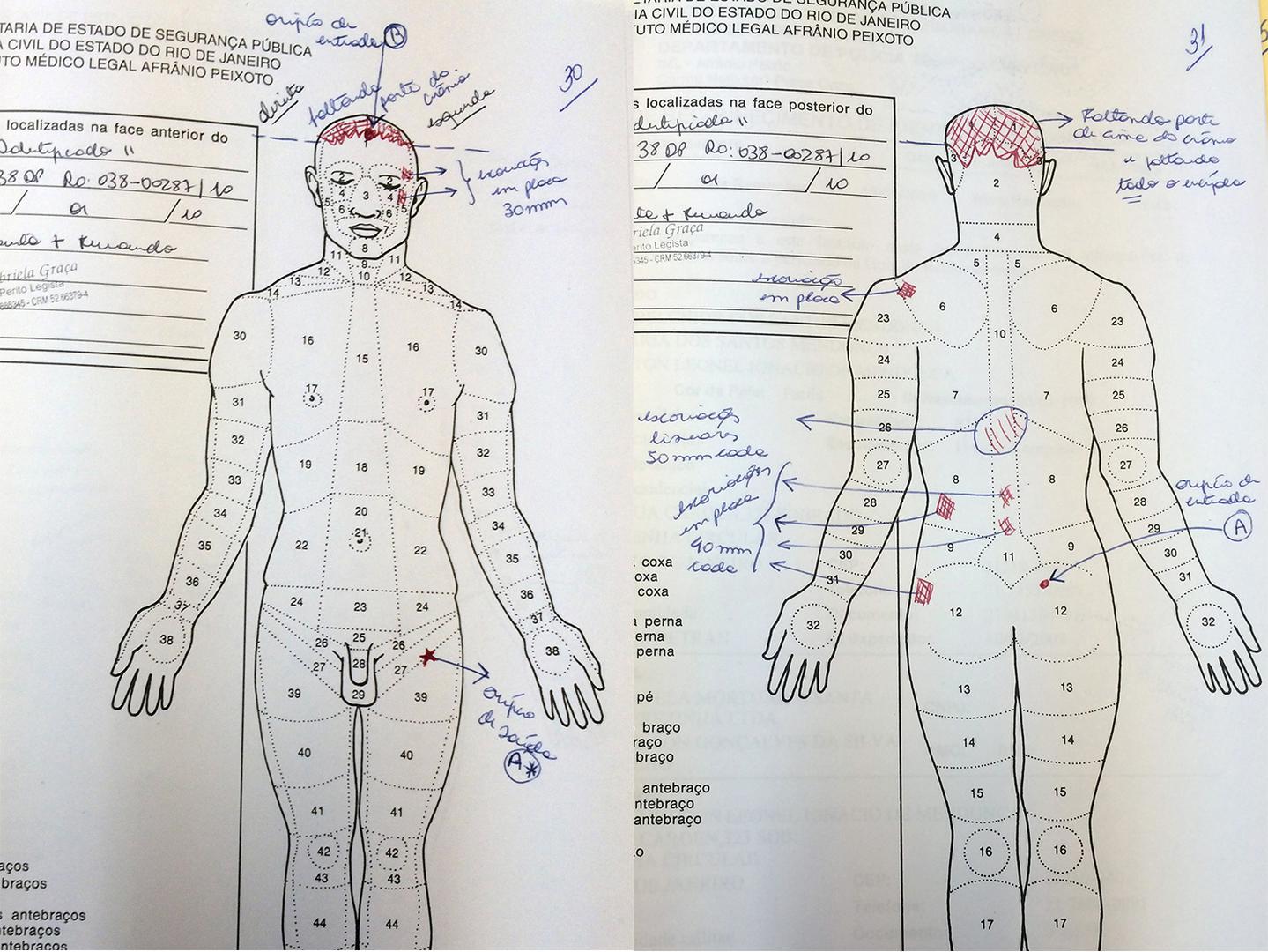  Romulo Belchior dos Santos Mendonça’s autopsy shows the loss of the top part of his skull, a shot to his buttocks, and several areas of excoriation on his back.  