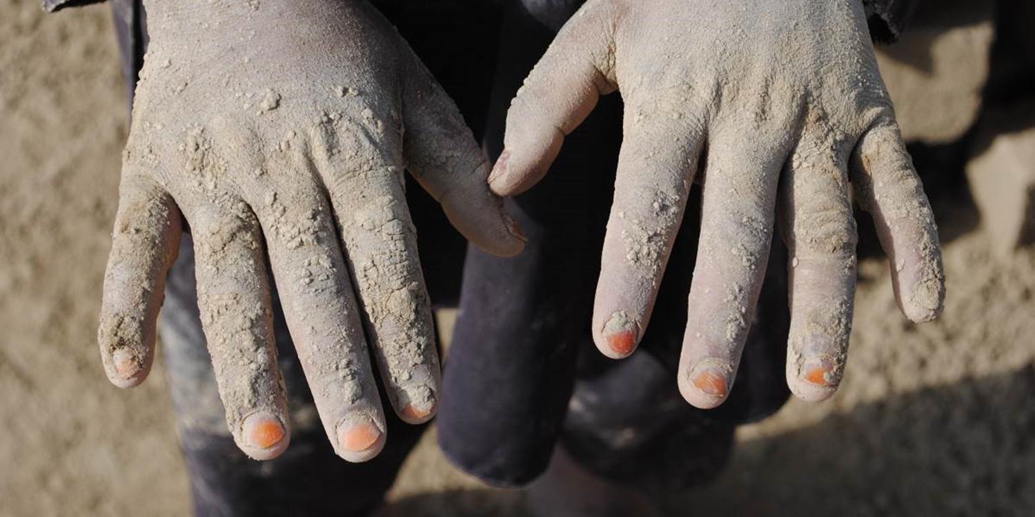 Helal, 10, works as a brick maker at a brick kiln outside Kabul. He told Human Rights Watch that the brick mold is heavy and his hands hurt working with wet clay. Helal doesn’t go to school because he has to work. 