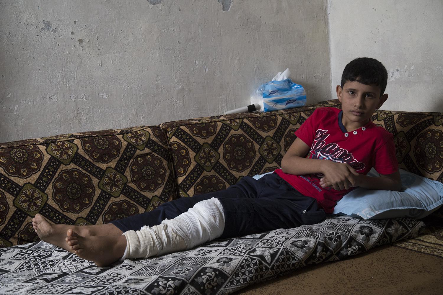 عدنان، 12 عاما،  كُسرت ساقه بانفجار عبوة ناسفة أثناء محاولته الفرار من مناطق سيطرة داعش أوائل أغسطس/آب. 