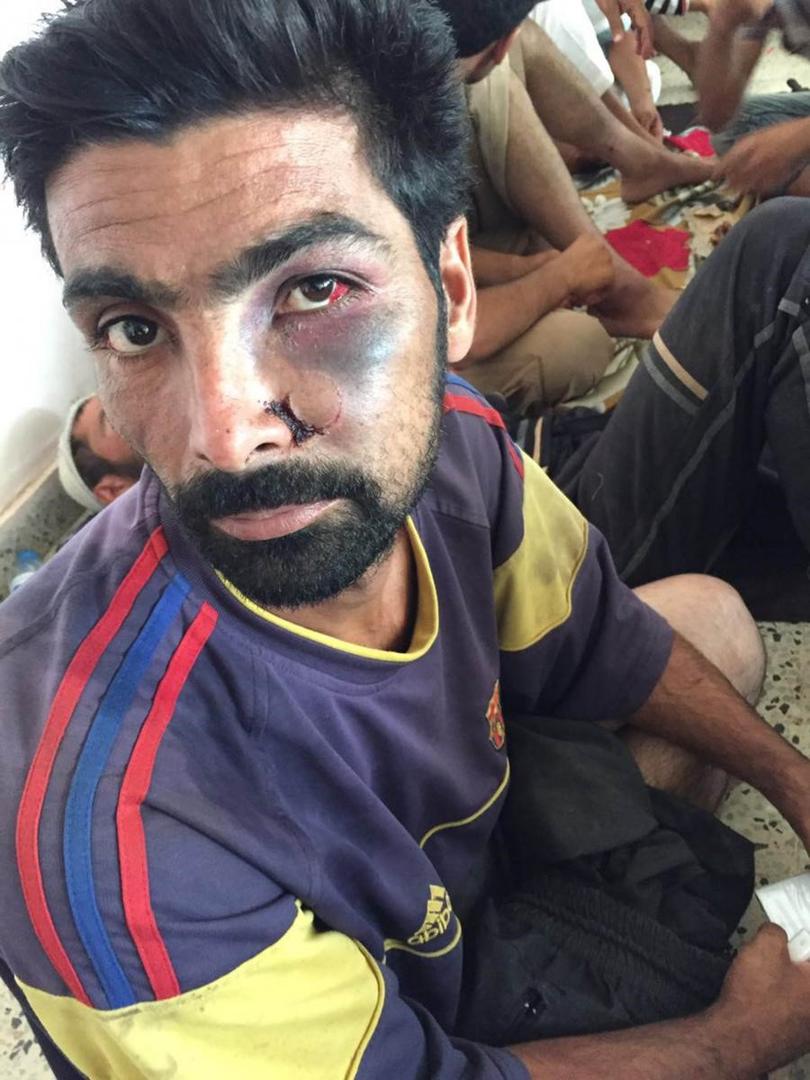 One of over 600 men and boys treated at Amiriyat al-Fallujah hospital who, according to individuals who interviewed many in the group, were abused Iraq’s Popular Mobilization Forces abused them in Saqlawiyah after capturing the village from ISIS 