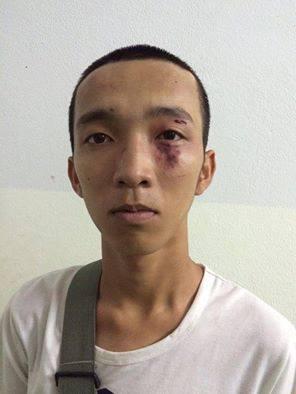 Huynh Thanh Phat after being assaulted in Ho Chi Minh City on May 10, 2016. 