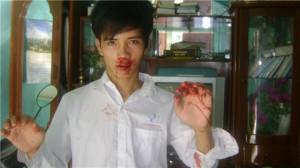 Nguyen Trung Ton’s 15-year-old son Nguyen Trung Trong Nghia after being assaulted in Thanh Hoa on June 28, 2010.