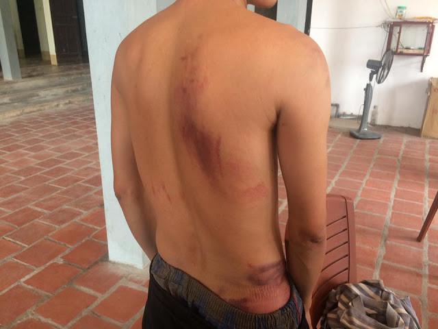 Nguyen Van Dung (also known as Dung Aduku) after being assaulted in Thanh Hoa on December 23, 2016.