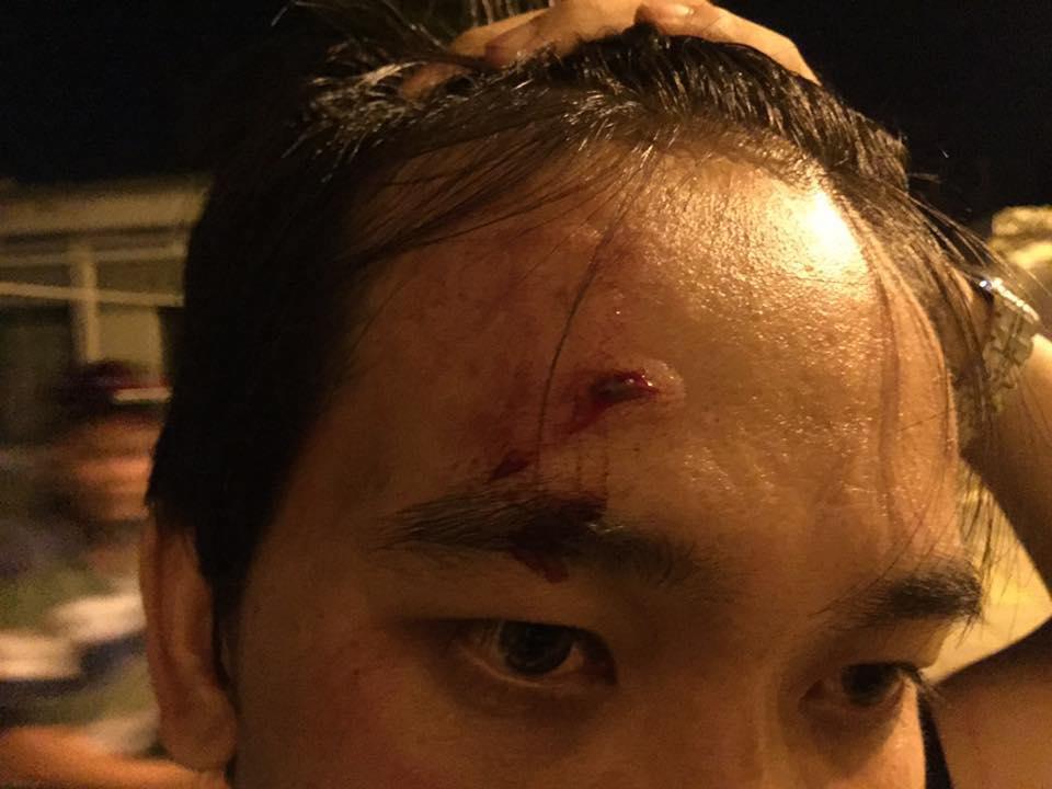 Nguyen Phuong after being assaulted on May 19, 2016, in Ba Ria – Vung Tau.