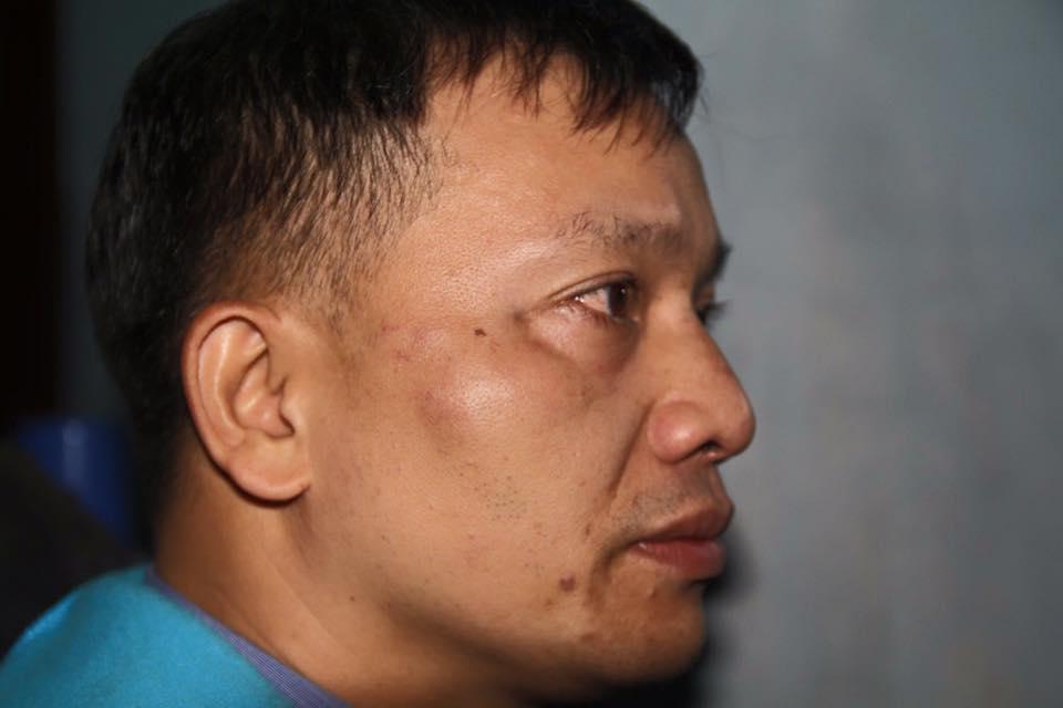 Nguyen Van Dai after being assaulted in Nghe An on December 6, 2015.