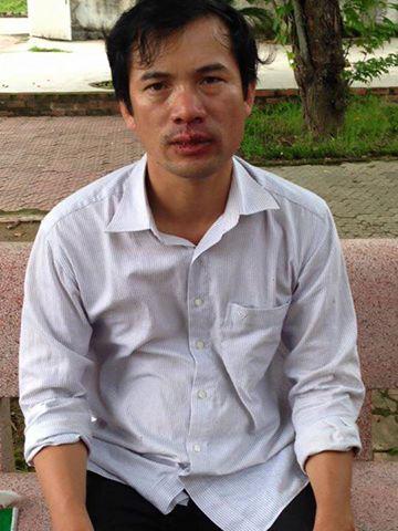 Nguyen Nang Tinh after being assaulted in Nghe An on November 24, 2015.