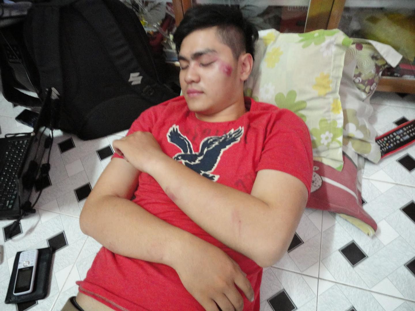 Nguyen Quang Trieu after being assaulted in Binh Duong on March 25, 2015.