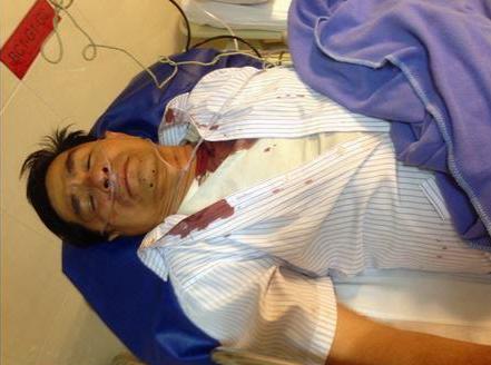 Nguyen Hong Quang after being assaulted in Binh Duong on January 18, 2015.