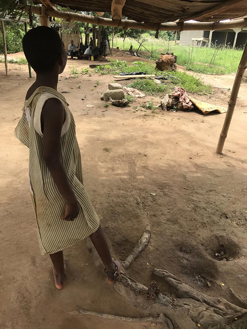 This girl was among 16 people with real or perceived mental health conditions released from shackles in Nyakumasi Prayer Camp, in Central Region, Ghana, on June 30, 2017