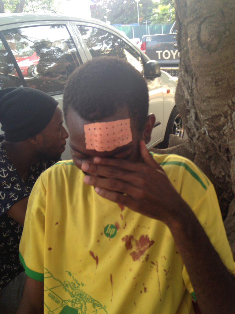 ​“Samussuku” Chiconda precisou de pontos na testa após ter sido espancado com bastões por agentes da polícia. Luanda, 24 de Fevereiro de 2017. 
