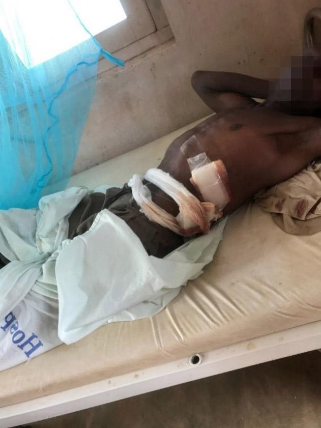 Um homem de 62 anos, na clínica Mucojo, após ter sido alegadamente ferido a tiro por um soldado no flanco esquerdo inferior. 