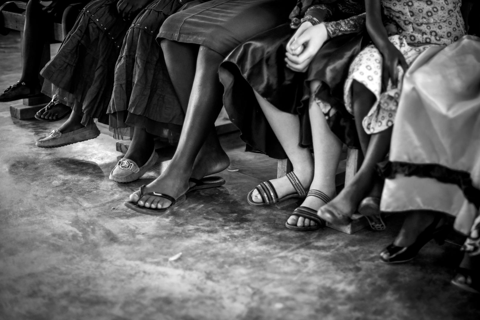 Children sitting in a row, among them one child with albinism. 