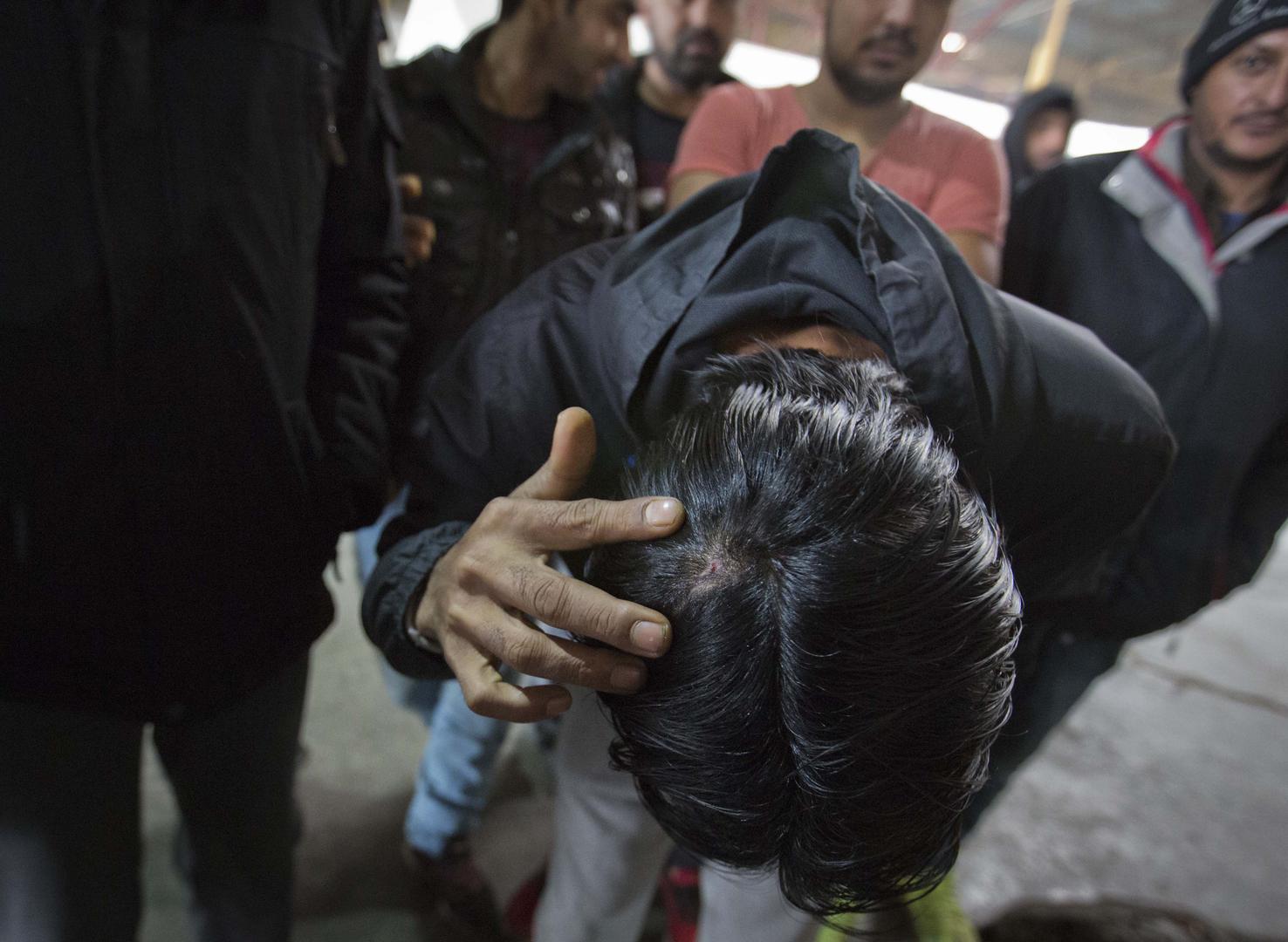 A migrant who claims he was beaten by Croatian police while attempting to cross the border to Croatia shows his injury at a factory hall turned migrants facility in Bihac, Bosnia-Herzegovina, Wednesday, March 13, 2019.