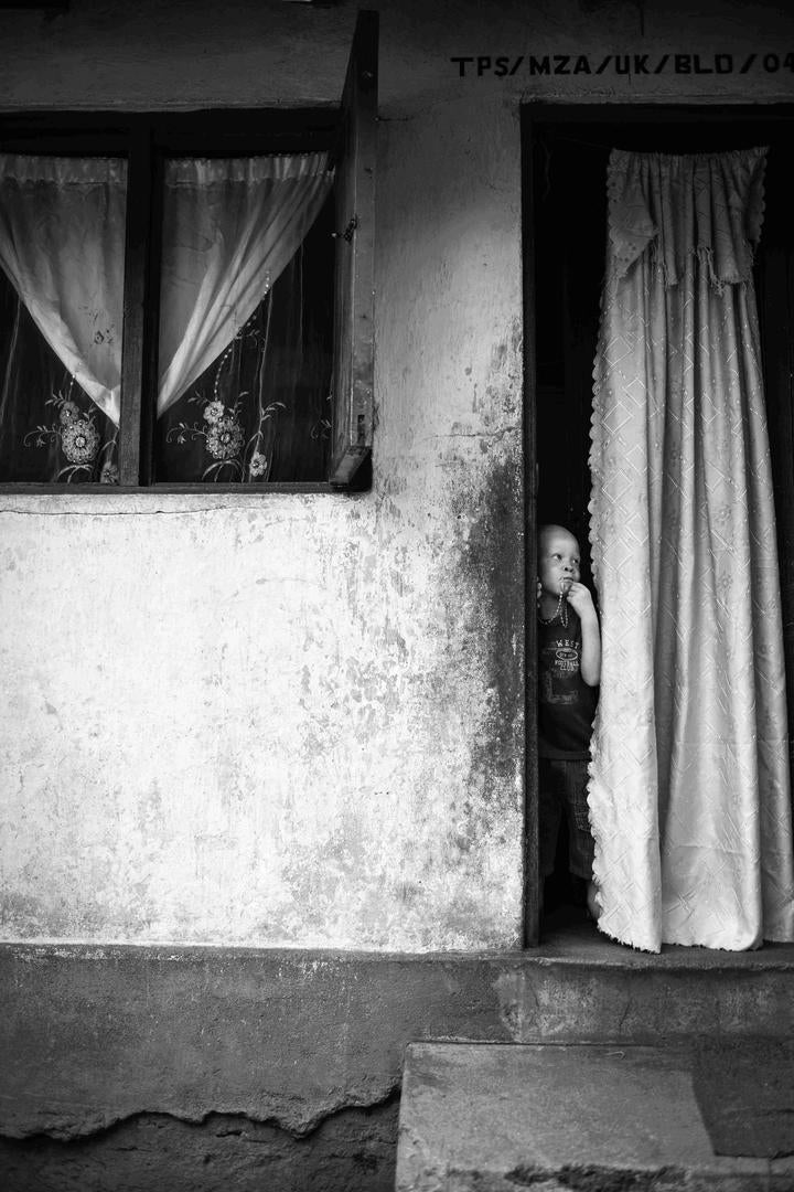 A boy with albinism looks out of the door of a house