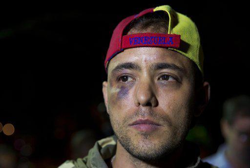 Venezuelan journalist Jesus Medina speaks with press in Caracas, Venezuela, Tuesday, Nov. 7, 2017. 