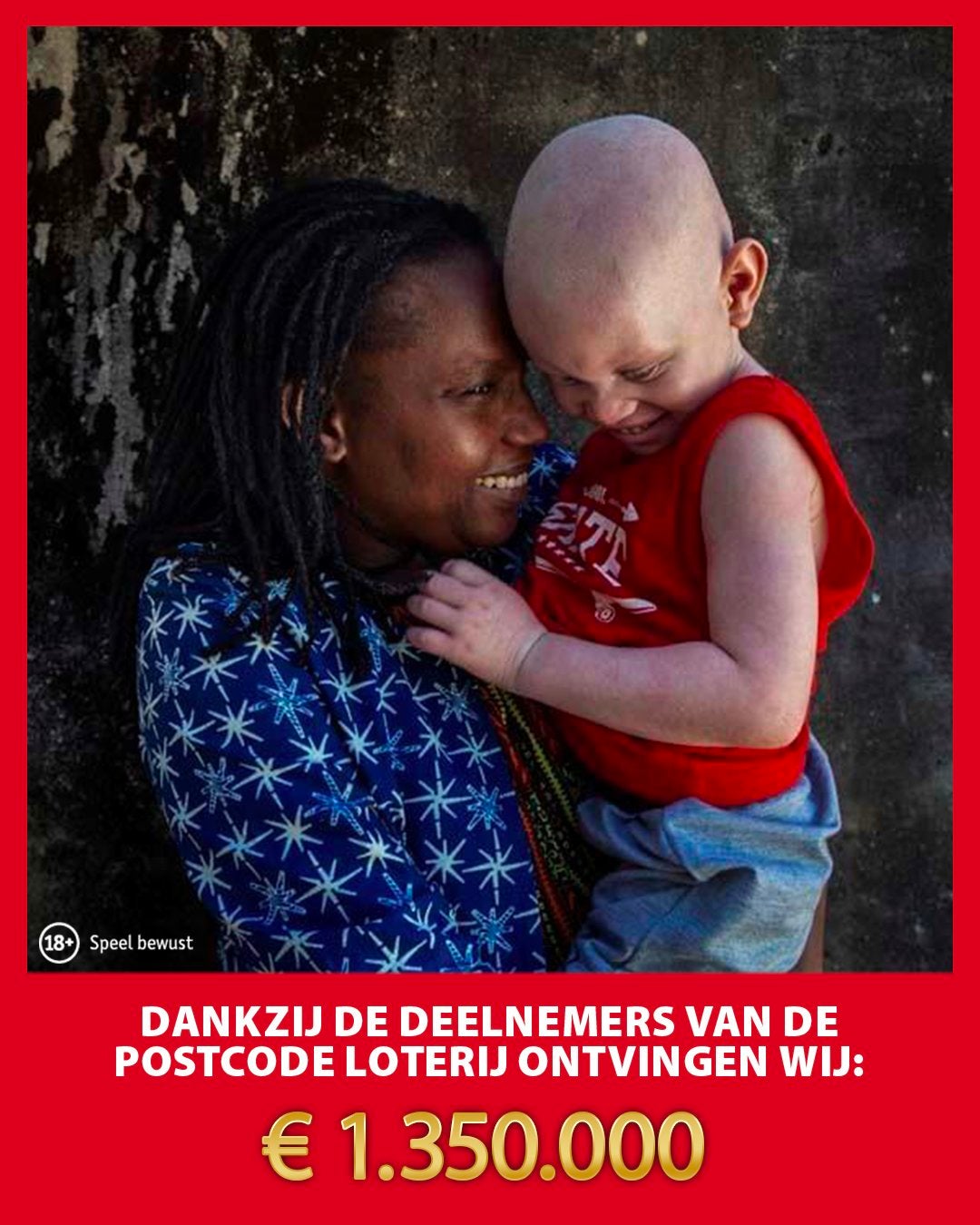 A mother holding a child with albinism