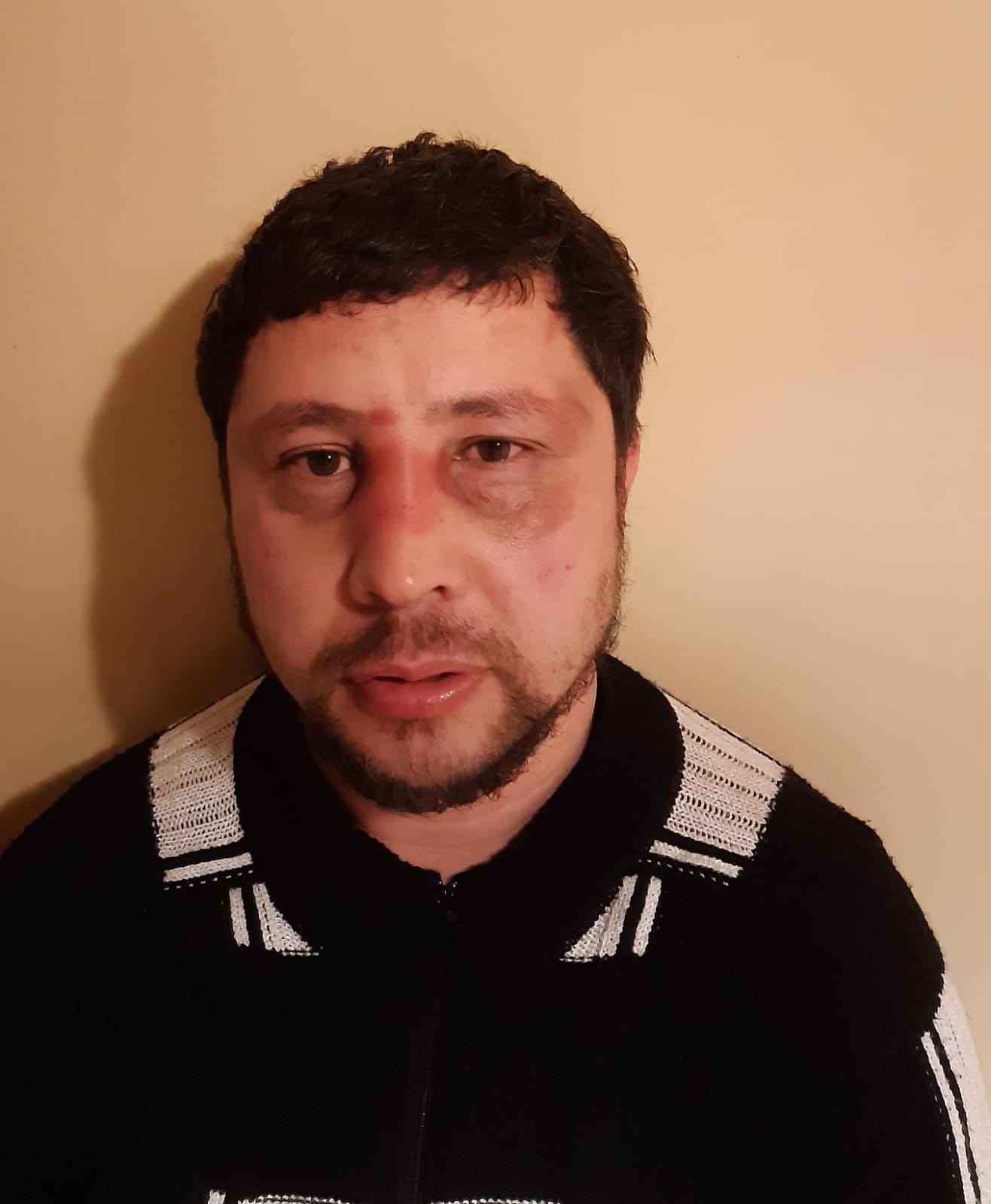 Ilhomjon Yakubov after the attack on March 16, 2020, Kaunas, Lithuania.