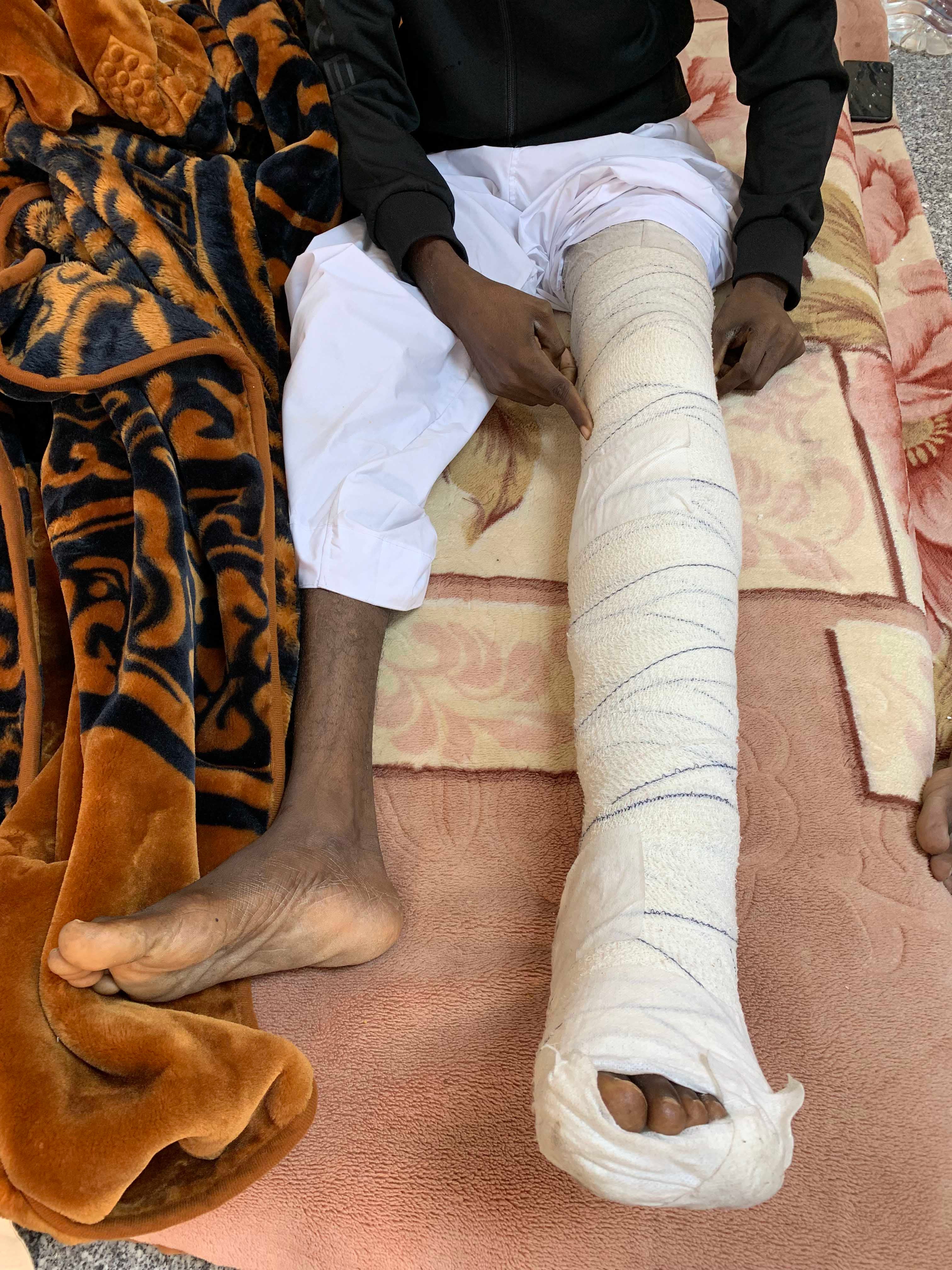 عامل مصنع يتعافى من إصابة في ركبته بعد هجمة بطائرة مسيّرة إماراتية على مصنع بسكويت في أطراف العاصمة الليبية طرابلس قتلت ثمانية مدنيين وجرحت 27 آخرين. ديسمبر/كانون الأول 2019، وادي الربيع، ليبيا.
