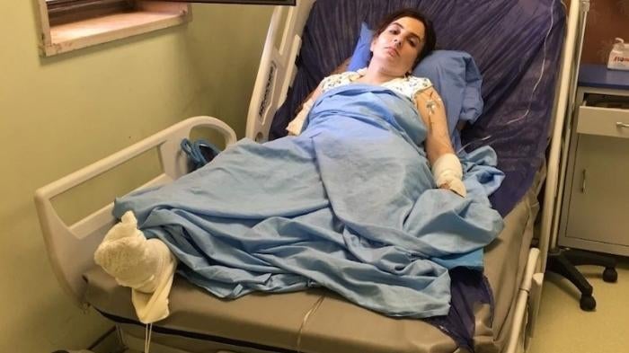 Payman Thalib Thaher lost her left leg in the Turkish airstrike at Kuna Masi water resort on June 25, 2020.