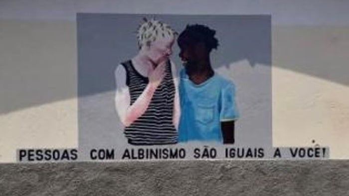 202010DRD_Mozambique_Albinism_Painting_FR