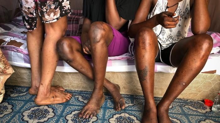 Three sex workers sit at their workplace in Juba, South Sudan on March 5, 2018.