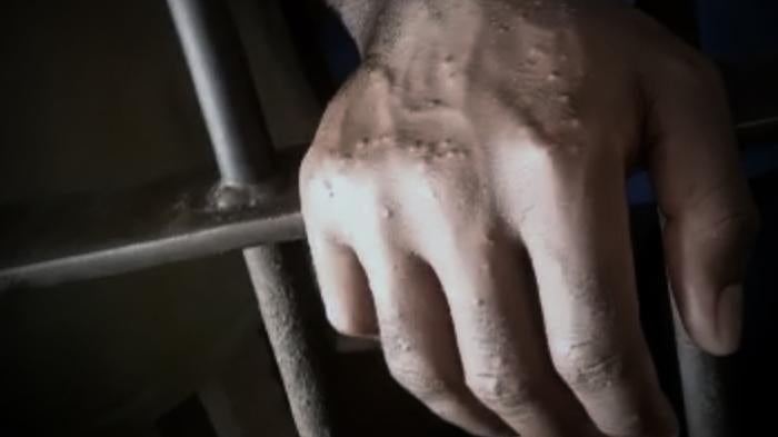 A hand reaches through bars