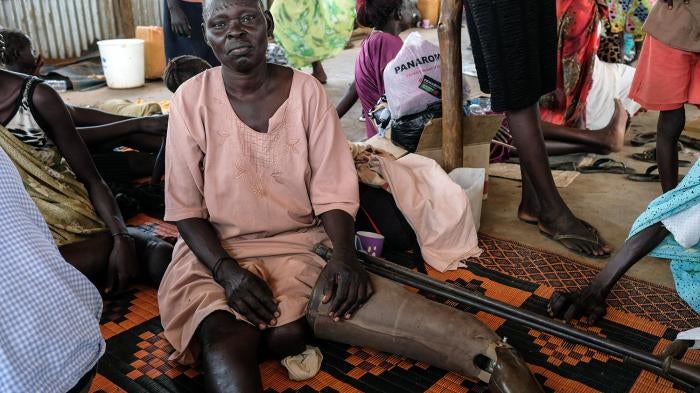 2)	Nyayak Olo Bapit, a Shilluk woman from Malakal, pictured in Juba. She was forced to flee Malakal after a bullet struck her left thigh during fighting there in January 2014.     