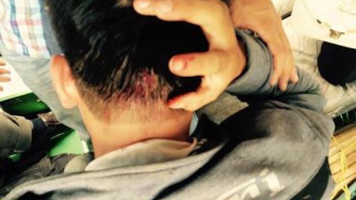 A man holding his head in pain with some blood visible, photo taken from behind